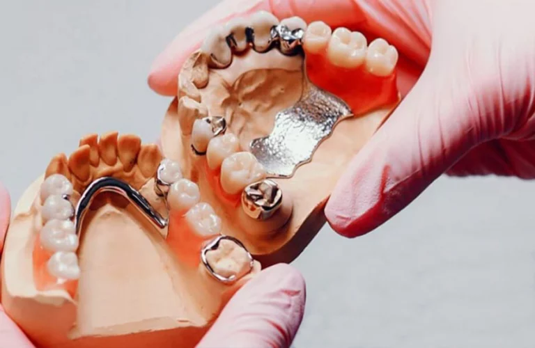 dentadura-postiza-removible-esqueletica-dentysalud