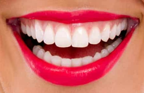 dientes-perfecto-dentista-manises-valencia