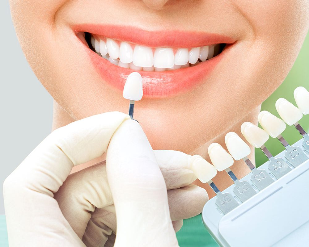 clinica-dental-manises-dentysalud-estetica-dental